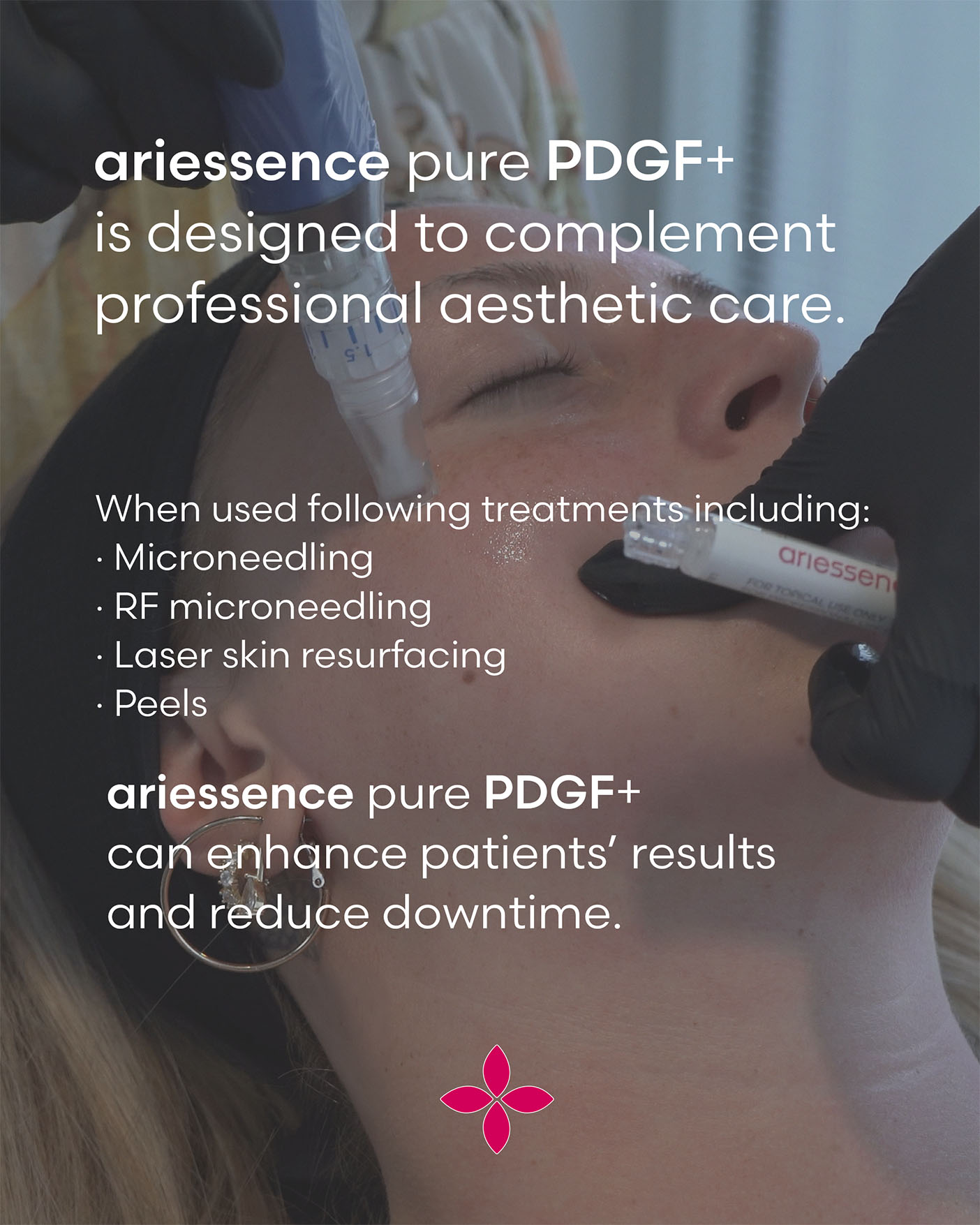 Microneedling treatment with ariessence pure PDGF+ applied to a patient